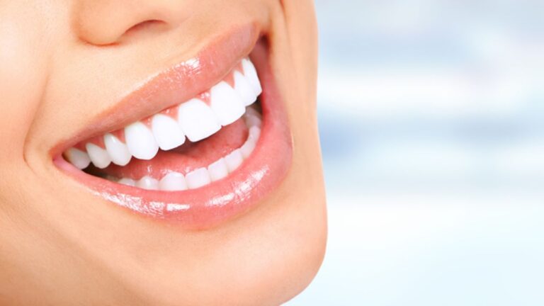 Clareamento dental a laser: vantagens e desvantagens e muito mais!
