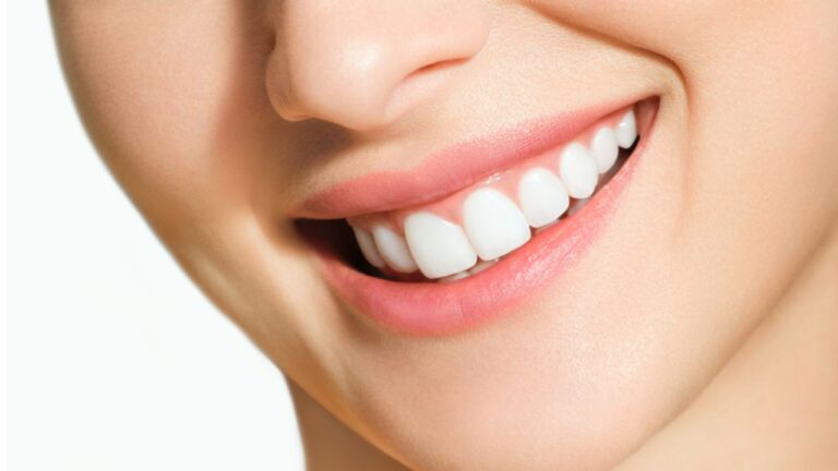 Tipos de clareamento dental: confira aqui 4 tipos!