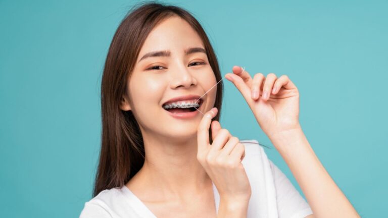 Conheça os 5 tipos de fio dental para aparelho!