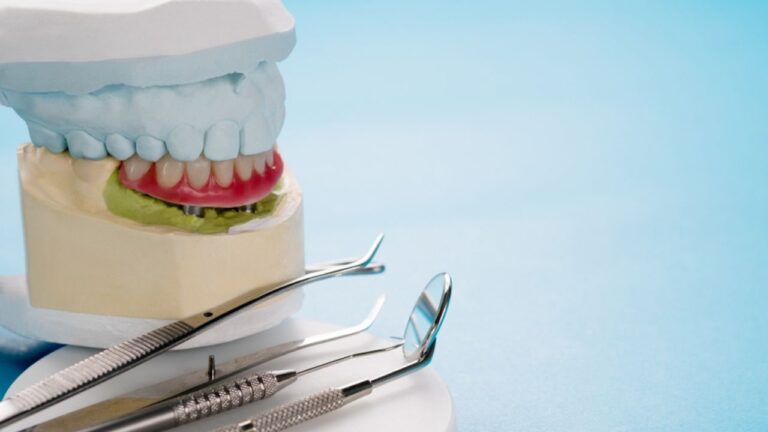 Prótese overdenture: indicações, vantagens e cuidados!
