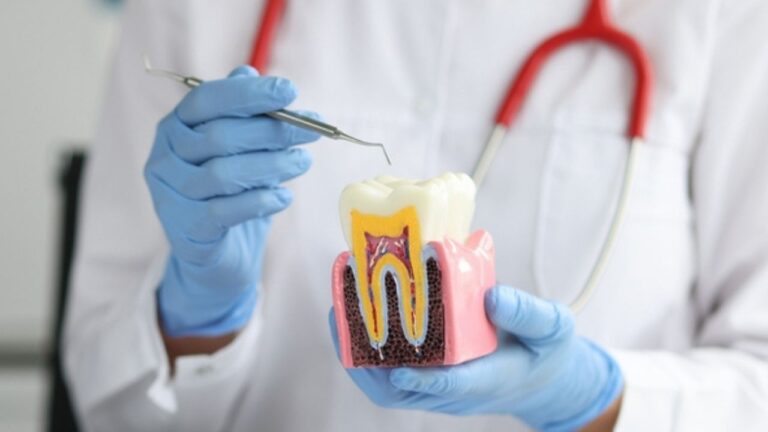 Como tirar cárie do dente: saiba quais são os procedimentos