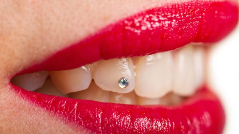 Piercing no dente: confira o que é e muito mais neste artigo