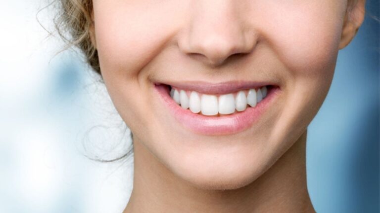 Resina nos dentes valor: confira o preço dos procedimentos