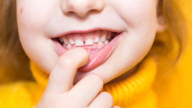 Má-oclusão dentária: veja quais são os principais tipos!