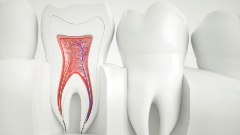Polpa do dente: confira tudo sobre o assunto!