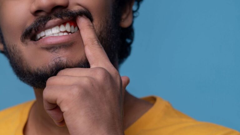 Doença periodontal: o que é, causas, sintomas e tratamento!