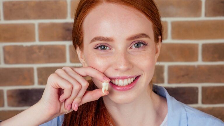 Dente siso: o que é, quando nasce e complicações que causa!