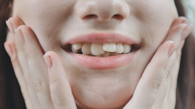Apinhamento dental: veja o que é e quais suas classificações