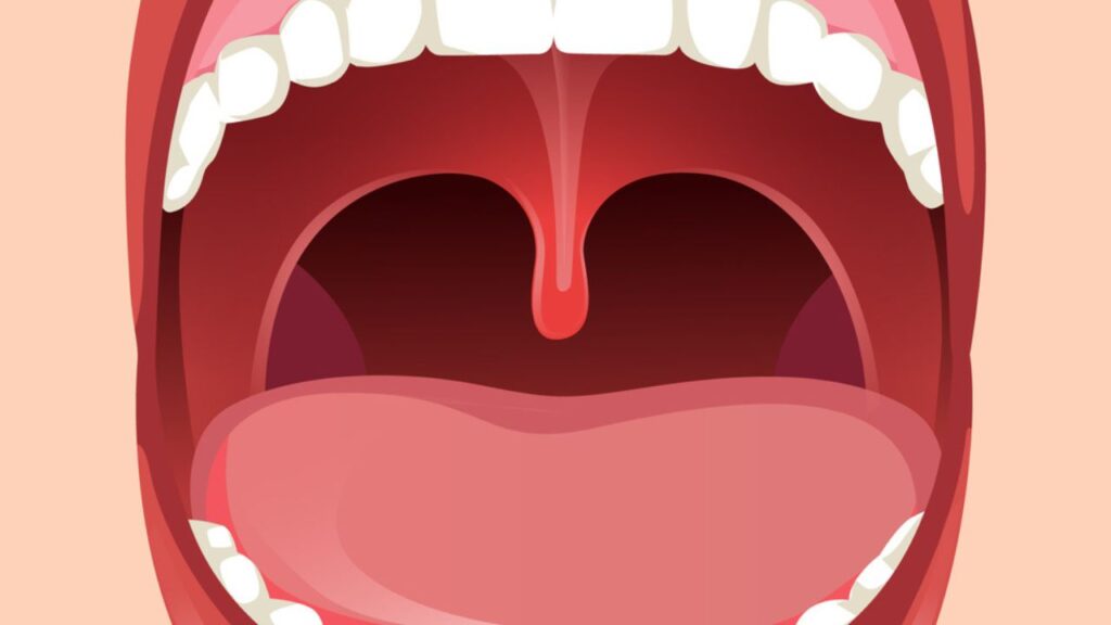 Céu da boca machucado: confira 6 causas para o problema!