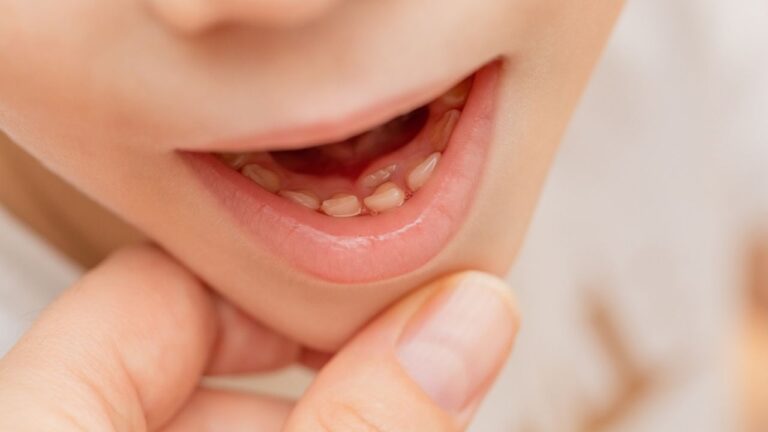 Como amolecer dente de leite mais rápido? Aprenda aqui!