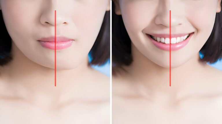 Cirurgia ortognática antes e depois: como é o procedimento?