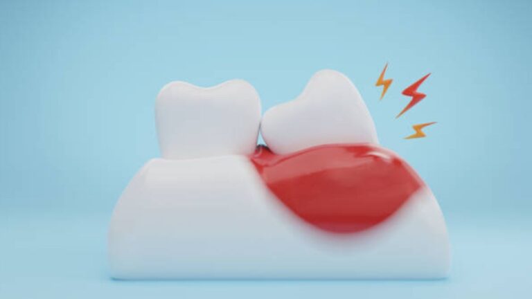 Qual o melhor antibiótico para dente inflamado? Saiba aqui!