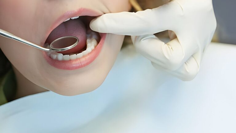 Dentes molares: qual é sua função e como cuidar! Saiba mais!