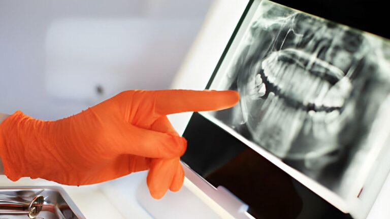 Panoramica dental: veja tudo sobre esse tipo de radiografia!