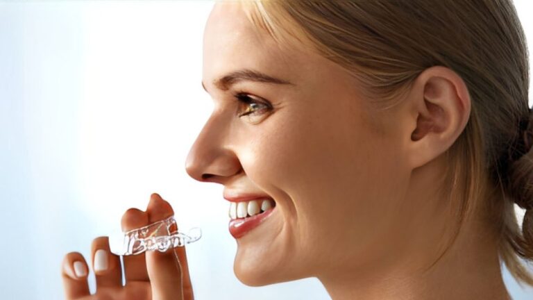 Clareamento dental caseiro com moldeira: saiba como funciona!