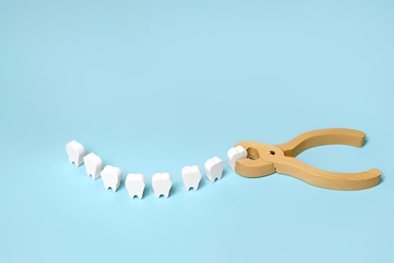 Extração de dente quantos dias de repouso são necessários? Guia Completo