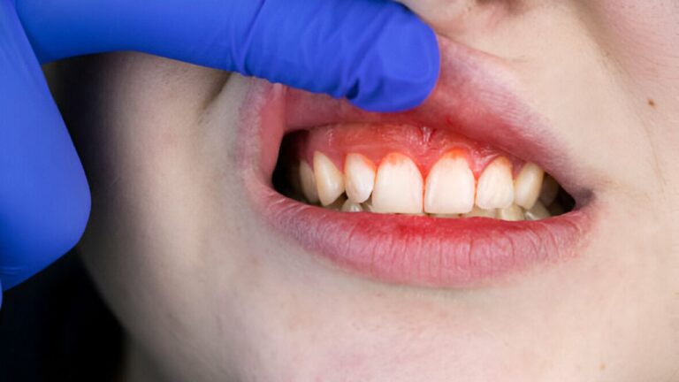 Periodontia: tudo que você precisa saber está aqui!