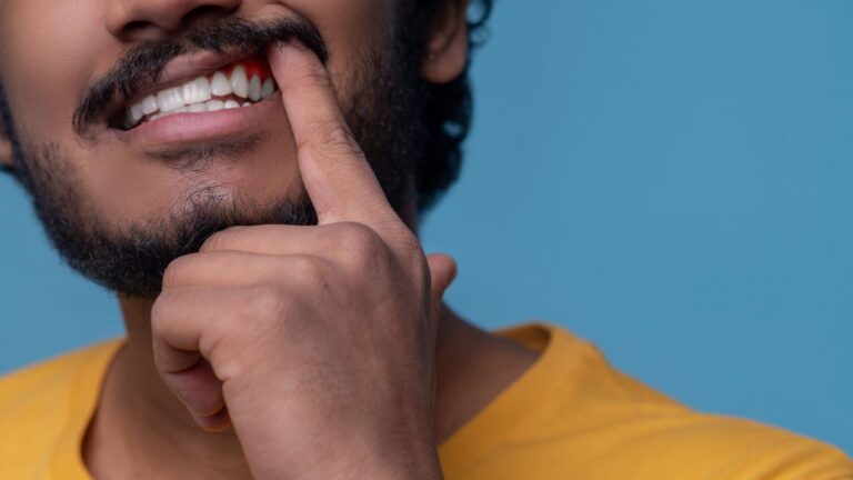 Lesão bucal: o que é, quais os tipos e como tratar