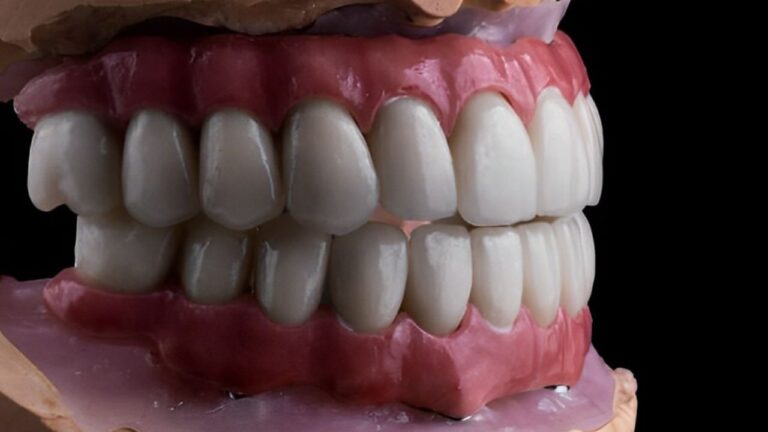 Dentadura: conheça os benefícios e como obter a sua!