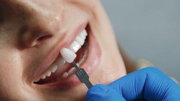 Prótese adesiva: o que é e como funciona